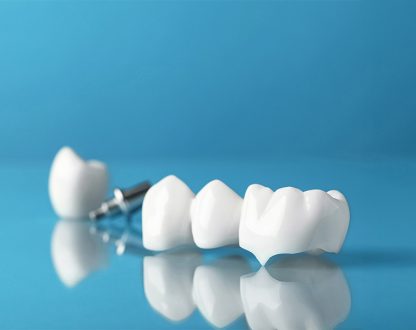 When Does a Tooth Need a Crown Instead of a Filling?