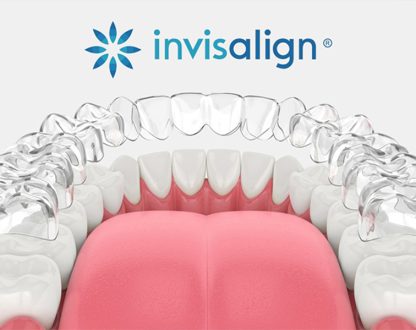 How Invisalign Aligners in Keller Work to Straighten Teeth